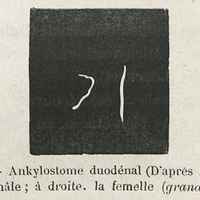 Fig. 14. — Ankylostome duodénal (D'après Eichhorst). A gauche, le mâle ; à droite. La femelle …