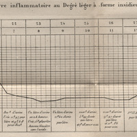 Fièvre inflammatoire au premier degré, forme insidieuse