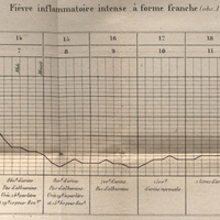Fièvre inflammatoire intense à  forme franche