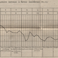 Fièvre inflammatoire intense à  forme insidieuse