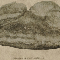 Ungulina Spermolepidis
